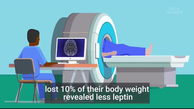 What Losing Weight Does To Your Body And Brain   The Human Body